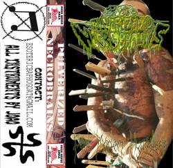 Post Mortem Hypostasis